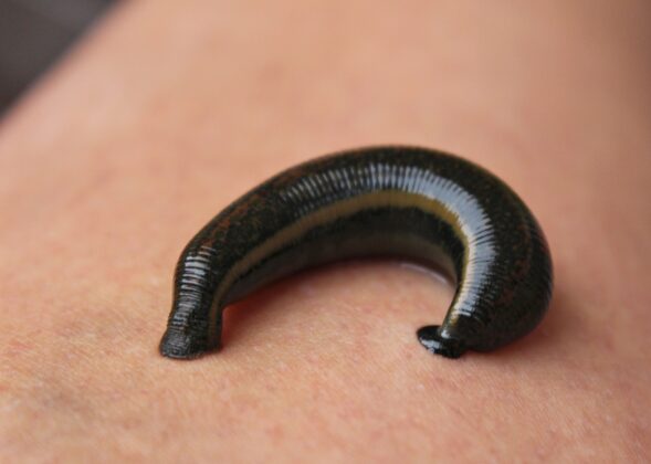 Leeches Reconsidered A therapeutic leech on skin